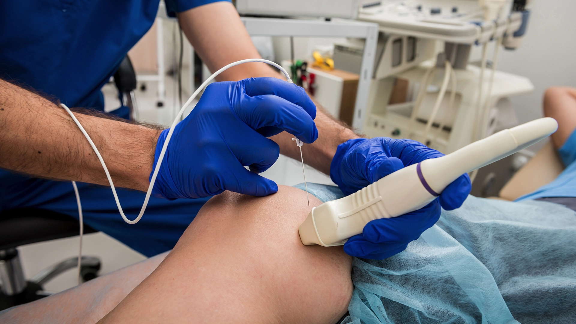 Radiofrequency Ablation